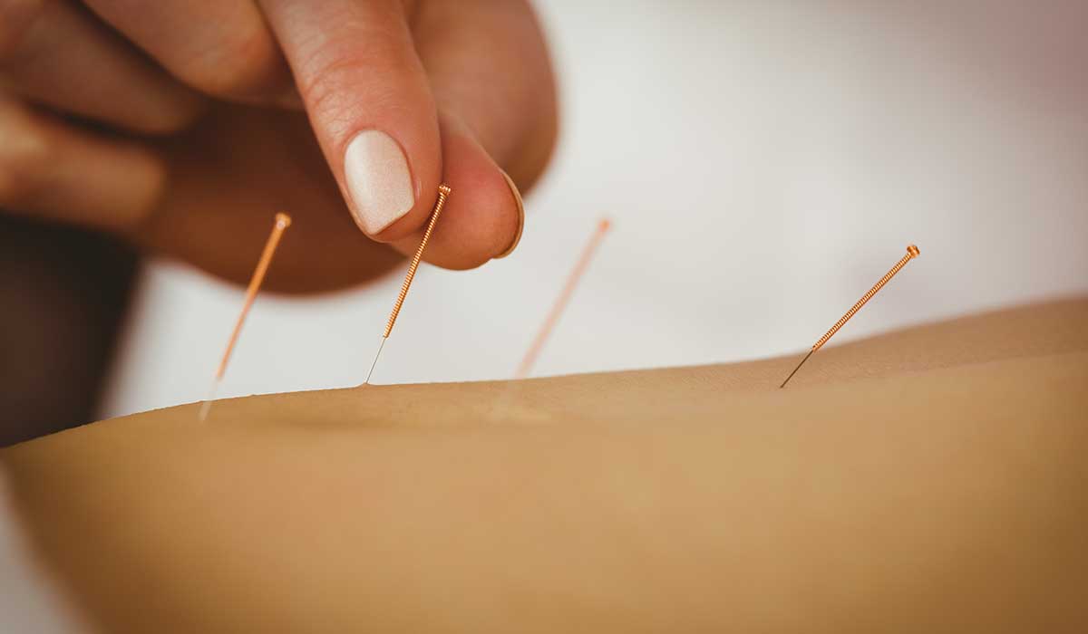 Acupuncture London London Osteopathy & Pilates